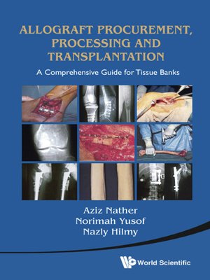 cover image of Allograft Procurement, Processing and Transplantation